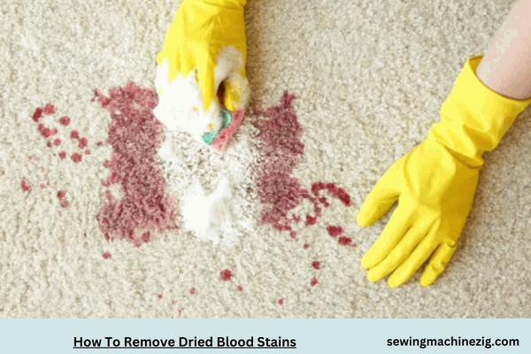 How To Remove Dried Blood Stains