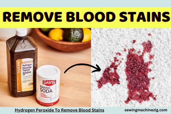 Hydrogen Peroxide To Remove Blood Stains