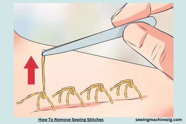 How To Remove Sewing Stitches 1